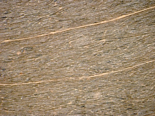 Phyllode minor nerves typically longitudinally anastomosing. From P.G. Wilson 10983 (PERTH), Bat Island (type locality).
